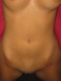/album/fotogaleria-inicio/coleccion-de-fotos-caseras-95-jpg/